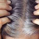  Grey hair not only for aged, but as genetic deficiencies