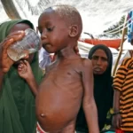  Somalia records increase in children suffering from malnourishment  NGO